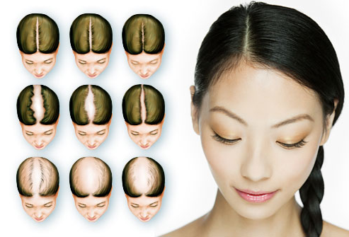 Natural Treatments To Cure Hair Fall