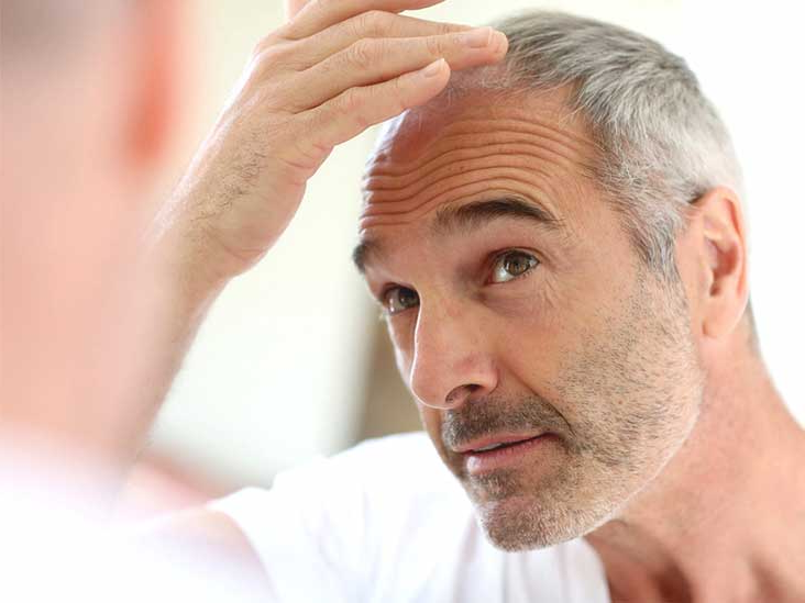 Why baldness is more common in older age?
